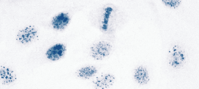 HEp-2000® ANA Colorzyme test system